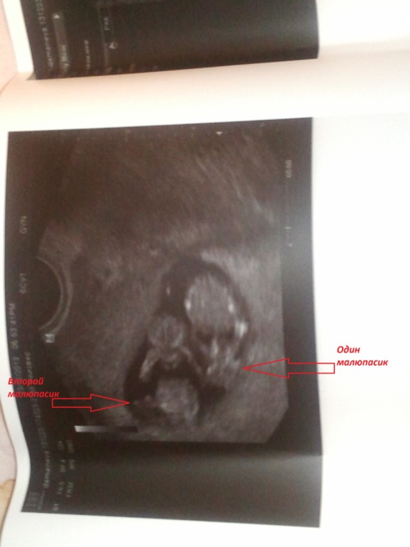 Принимайте новичка))).