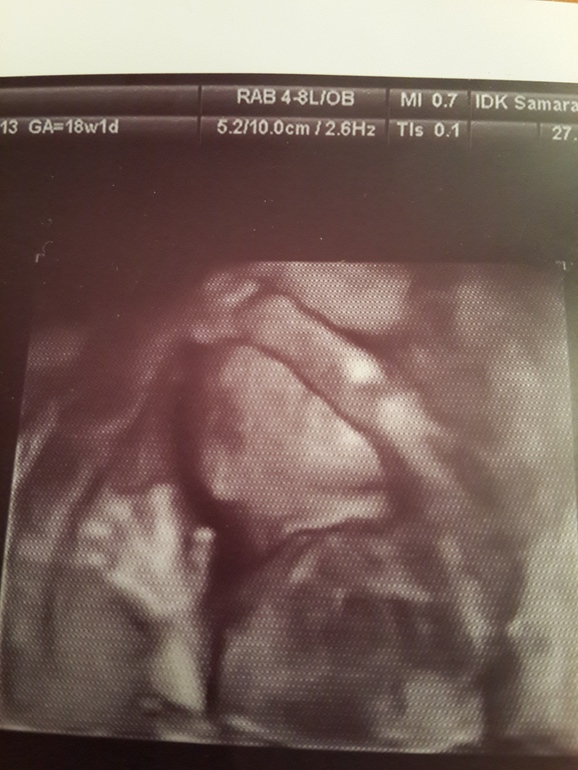 фото моей дочи,возраст 18 недель )))