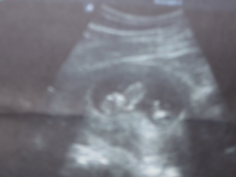 Моя жизнь после " конец света "