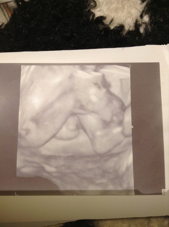 Девочки, помогите с полом. Определиться, развеять сомнения))