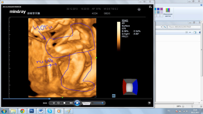 Девочки, помогите с полом. Определиться, развеять сомнения))