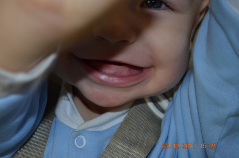 Зубы это или нет?