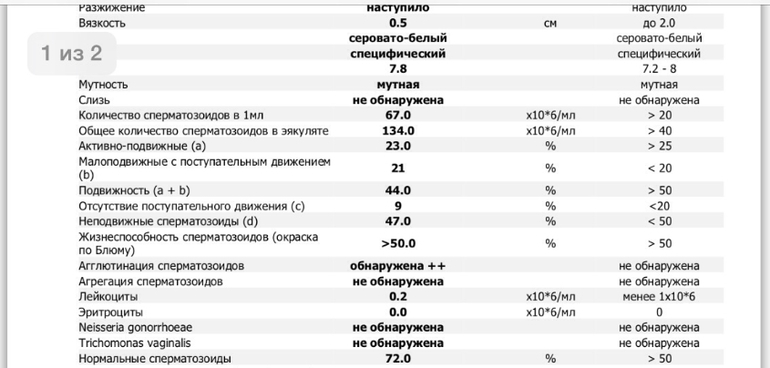 Девули, посмотрите СГ, все плохо?((((