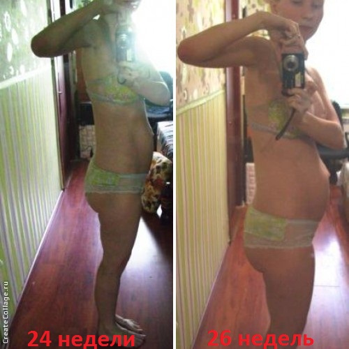 Нам 26 неделек
