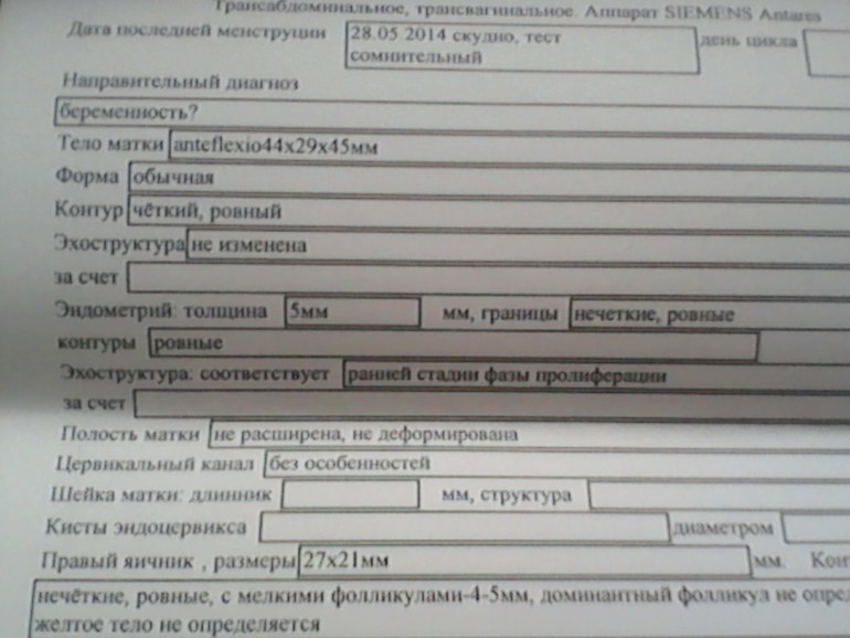 Результаты УЗИ! АНОВУЛЯТОРНЫЙ ЦИКЛ!