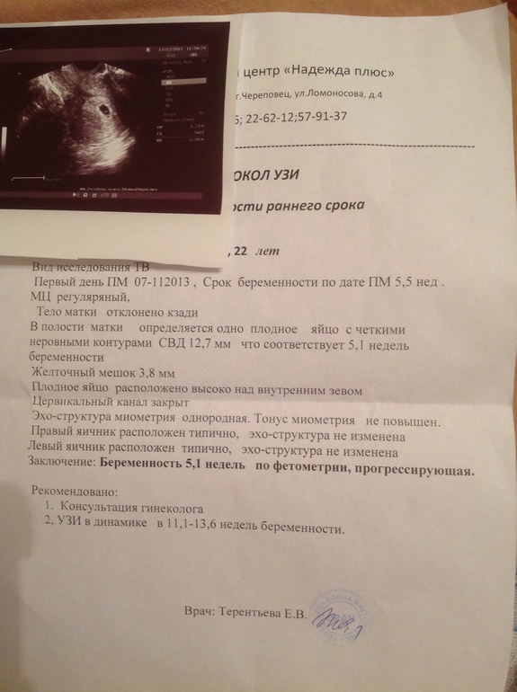 Первое узи)))на 6 недельке))