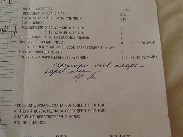 КТГ на 38 неделе