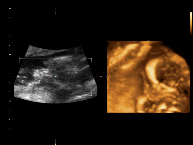 Ура! У нас в домике МАЛЬЧИК!