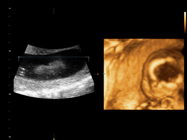 Ура! У нас в домике МАЛЬЧИК!