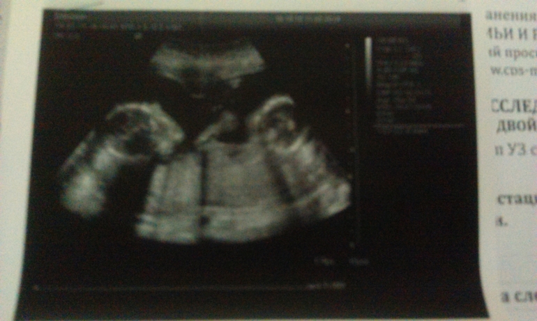 Сходили в ЦПиРС.