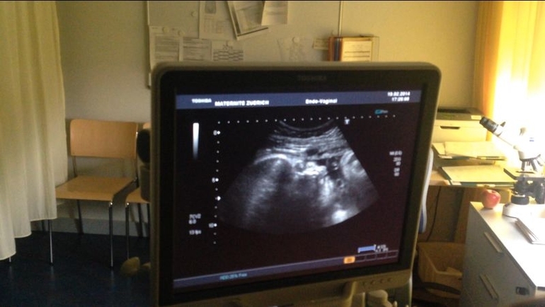 наши портретные Узи в конце 38-ой недели