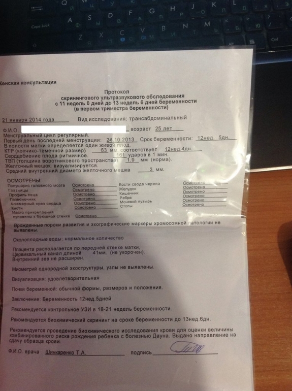 13 недель!