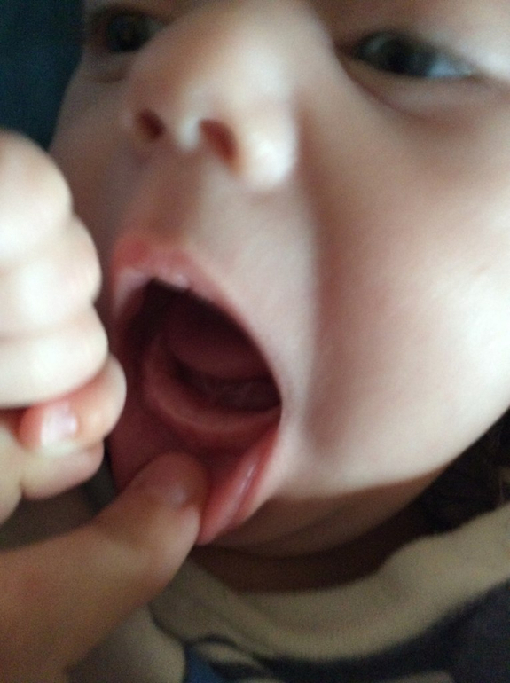 Зубы или нет?