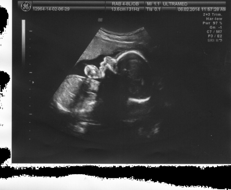 Узи!!!!!!21 нед