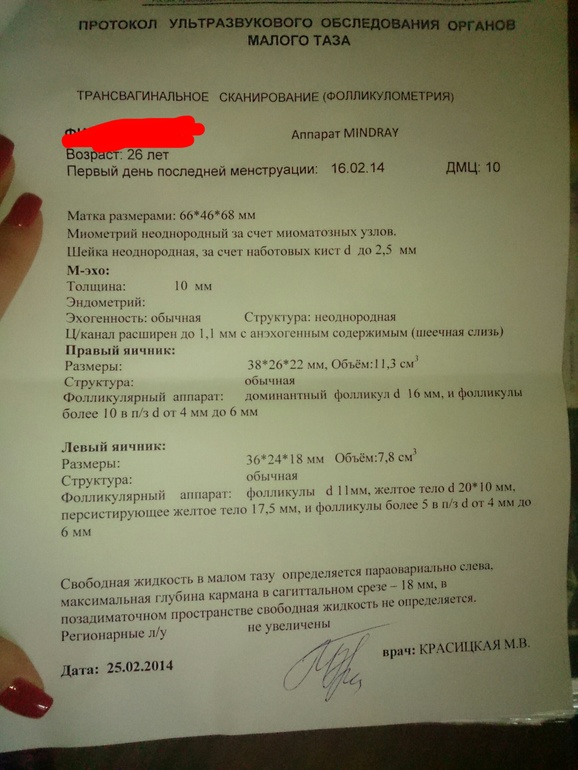 Девочки,миленькие!!! Очень нужны ваши комменты, кто разбирается помогите разобраться,пожалуйста)))