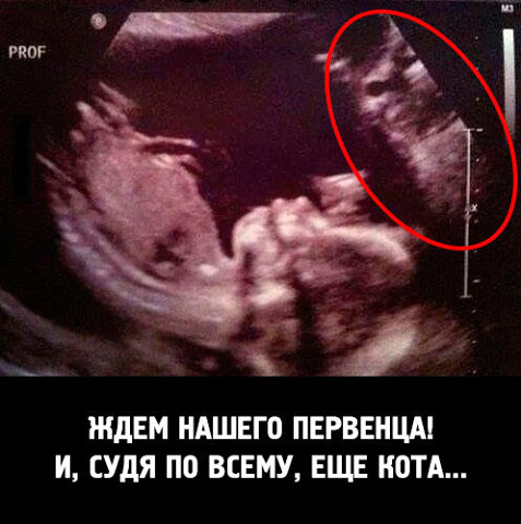 И такое бывает)))