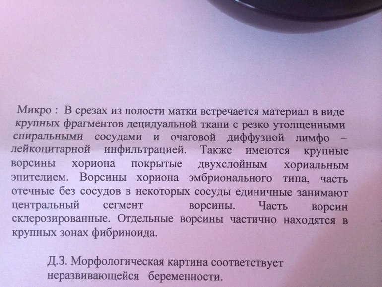 Не понимаю,что написано