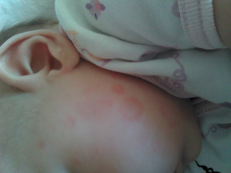 обсыпались(