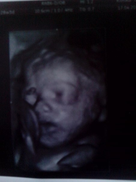 ))))) фоточки