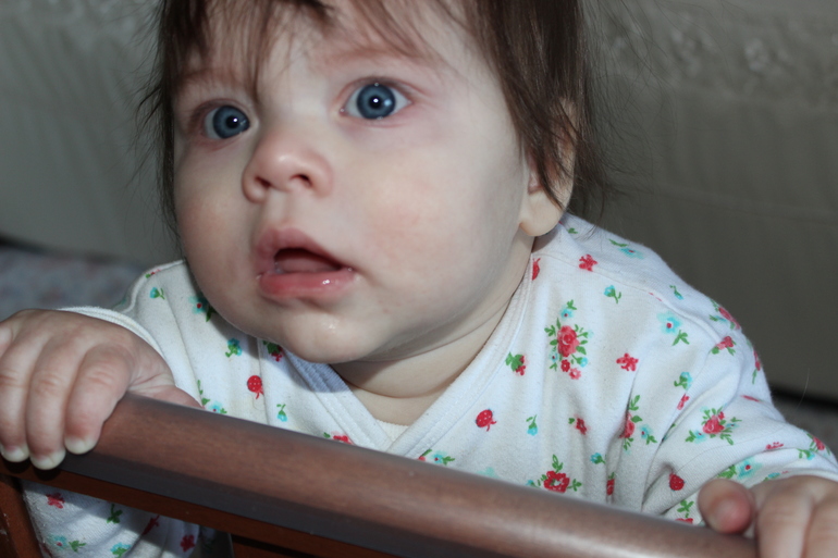 Аллерния на смесь