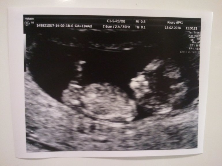 11+4, или какой чудесный день=)