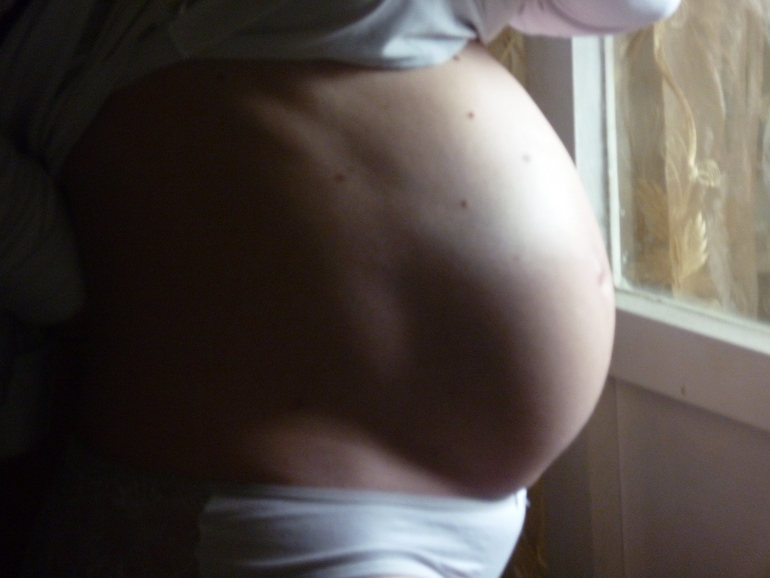 Нам 34 недельки!) Вот я решилась показать его, был такой малюсенький!))))