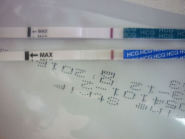 10 ДПО.....вроде есть надежды!!!