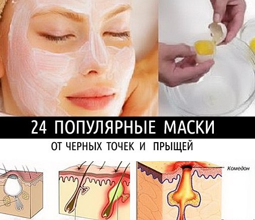 Как сделать чёрную маску от прыщей и чёрных точек Как сделать чёрную маску от прыщей и чёрных точек