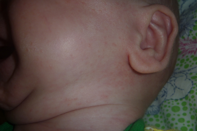 подскажите что это аллергия или что другое????