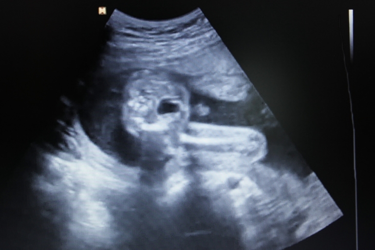 УРРРРАААААААААА!!!!!!!!!!! УЗИ в 21 неделю)))))))