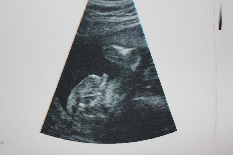 УРРРРАААААААААА!!!!!!!!!!! УЗИ в 21 неделю)))))))