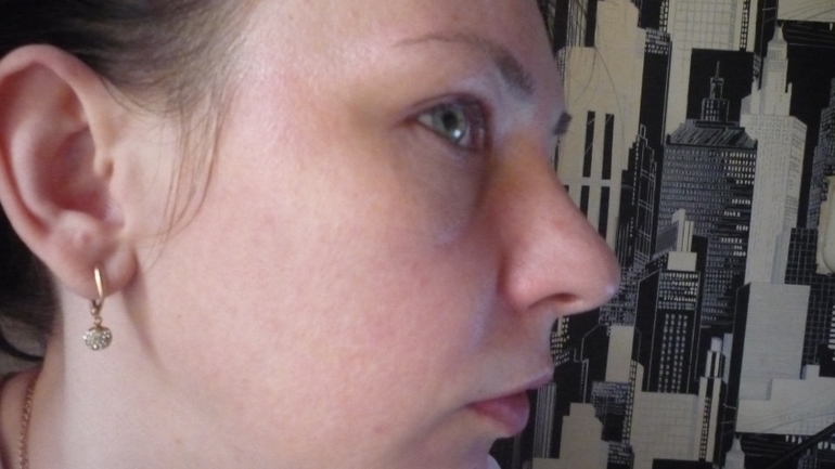 Оцените результат .уход за лицом в течении года.