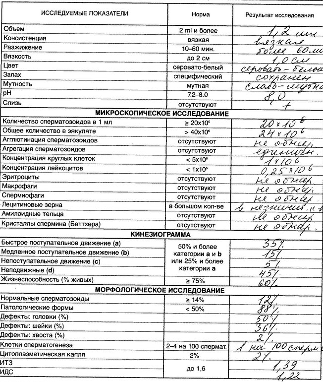 kak-poschitat-kolichestvo-spermatozoidov kak-poschitat-kolichestvo-spermatozoidov