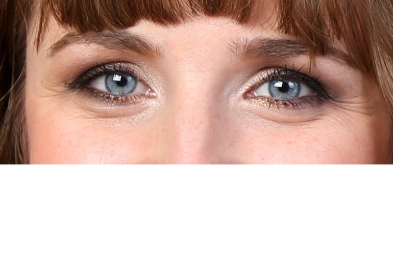 мимические морщины......