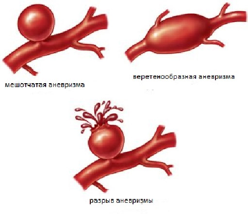 С мамой случилась беда
