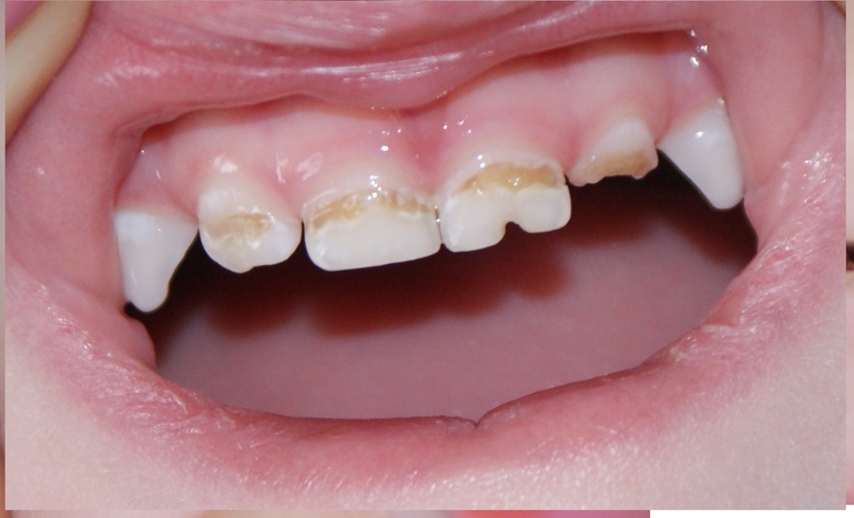 Подскажите, что нам делать!