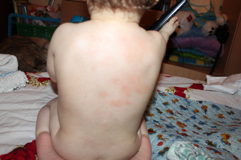 Мы все про свои пятна...не можем выявить от чего...Help...