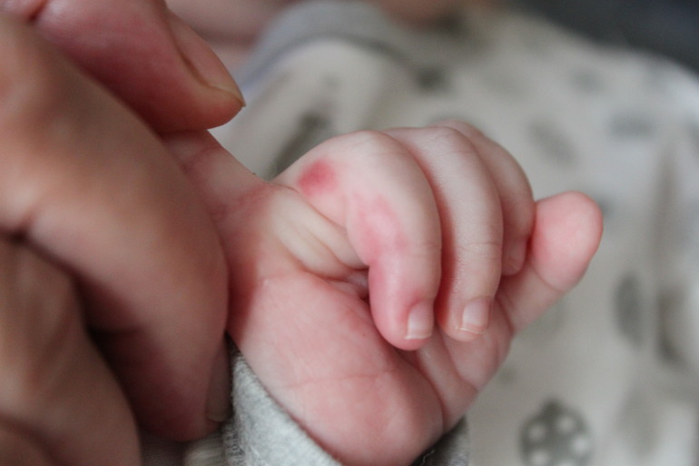 Что приложить,чем помазать?