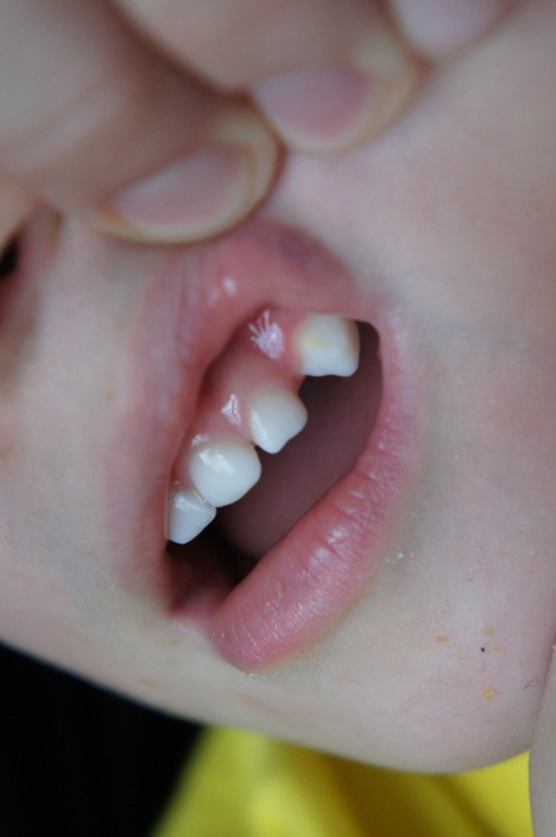 Желтое пятно