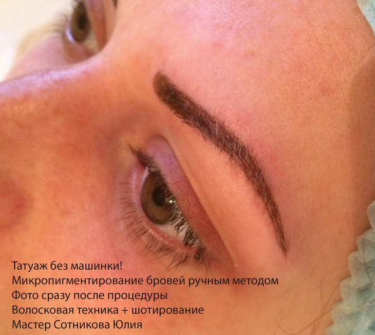 Красные пятна на теле при раке (фото) Красные пятна на ногах: фото, причины появления. Красные