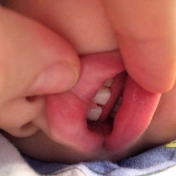 Проблемы с зубами, нам 1,8.