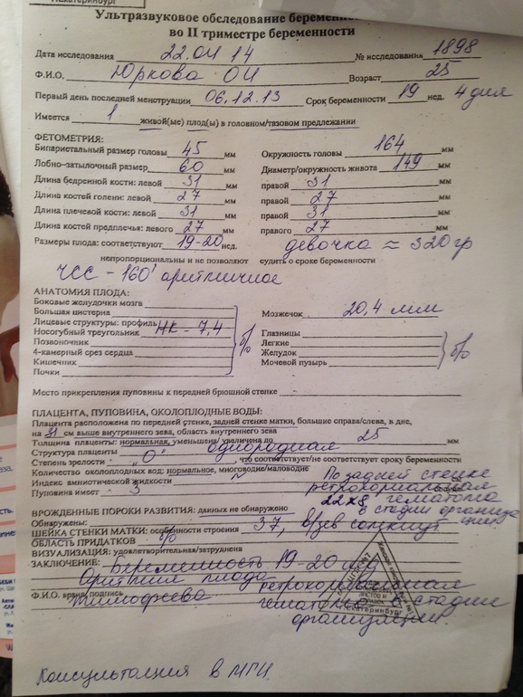 Были сегодня на Узи