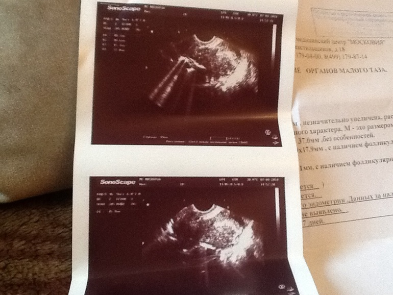 Узи и тесты