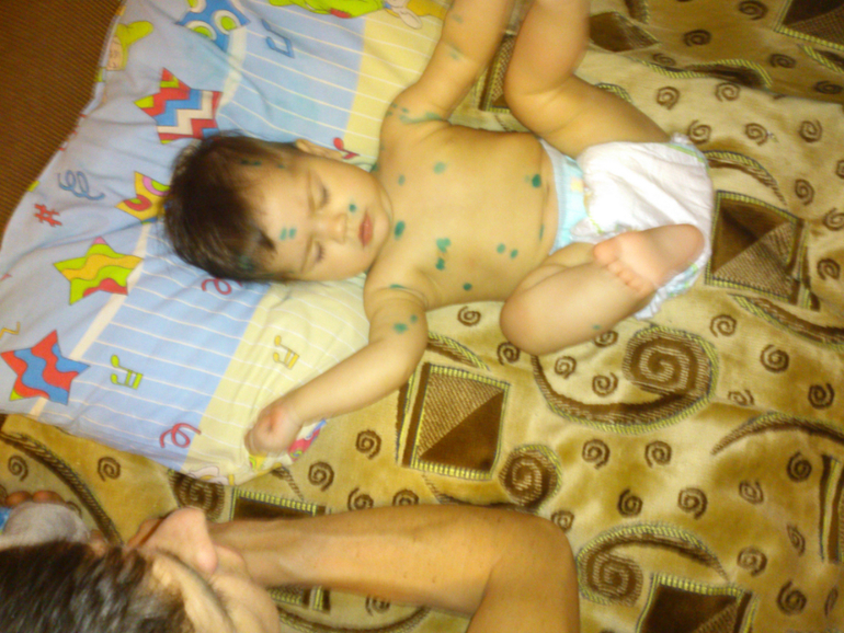 и все таки она пришла........ ветрянка!!!!!! День 1