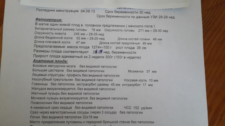 30 неделек ( наше УЗИ)