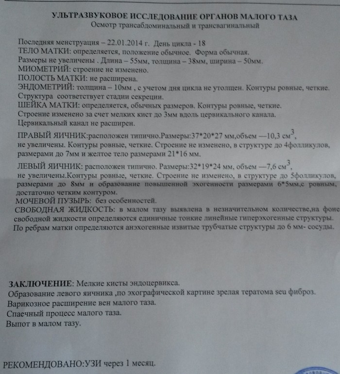 Еще раз про Узи