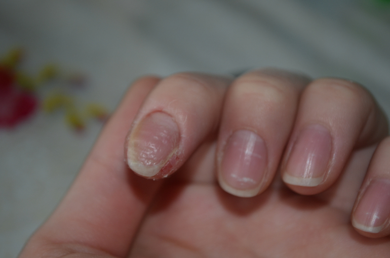 Что может быть с пальцем? Может у кого было