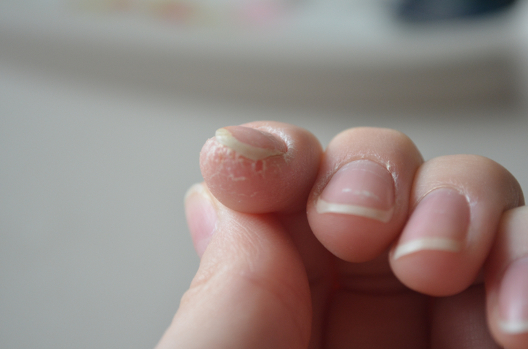 Что может быть с пальцем? Может у кого было