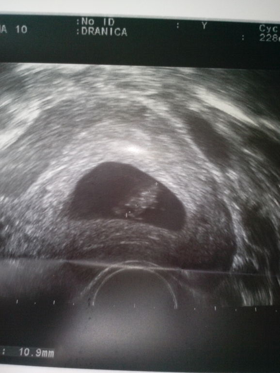 была на узи и вот что