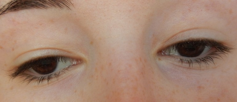 Межресничное пространство и стрелки.